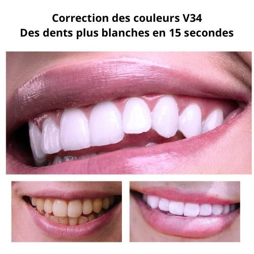 𝑩𝑳𝑨𝑵𝑪𝑯𝑰𝑺𝑺𝑬𝑼𝑹 𝑫𝑬 𝑫𝑬𝑵𝑻𝑺 Mousse V34
