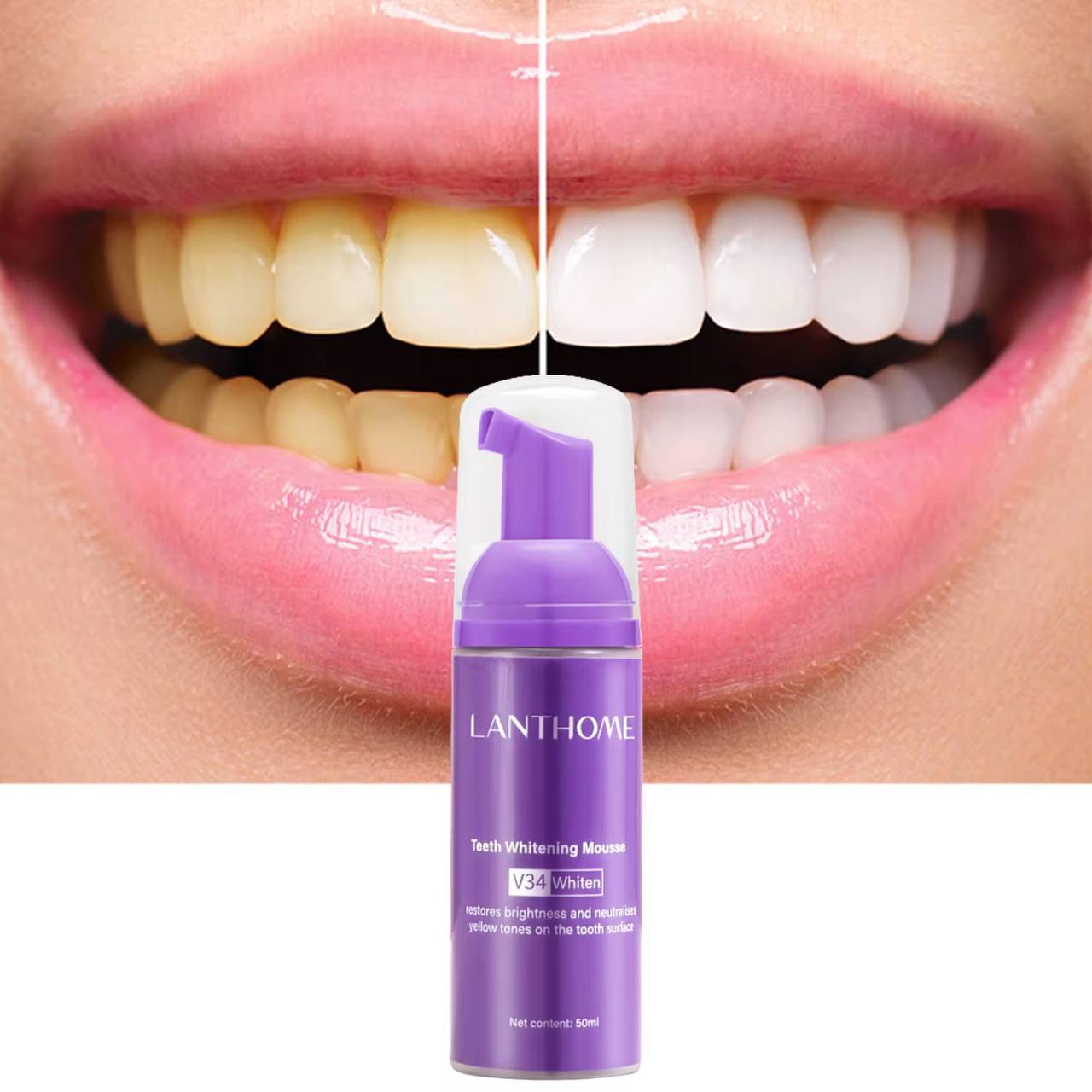 𝑩𝑳𝑨𝑵𝑪𝑯𝑰𝑺𝑺𝑬𝑼𝑹 𝑫𝑬 𝑫𝑬𝑵𝑻𝑺 Mousse V34